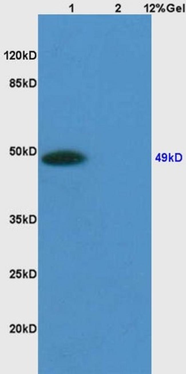 Sphingomyelin Synthase 1 Antibody in Western Blot (WB)