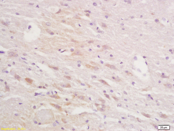 Squalene Epoxidase Antibody in Immunohistochemistry (Paraffin) (IHC (P))