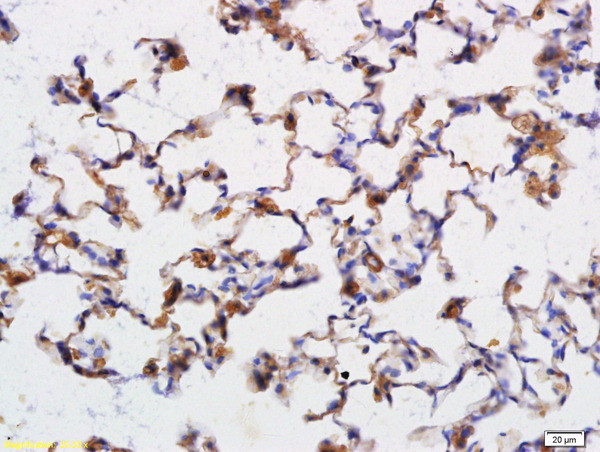 TBLR1 Antibody in Immunohistochemistry (Paraffin) (IHC (P))