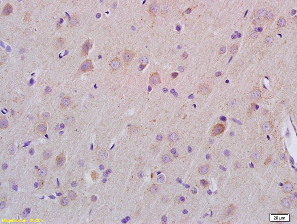 ZDHHC21 Antibody in Immunohistochemistry (Paraffin) (IHC (P))