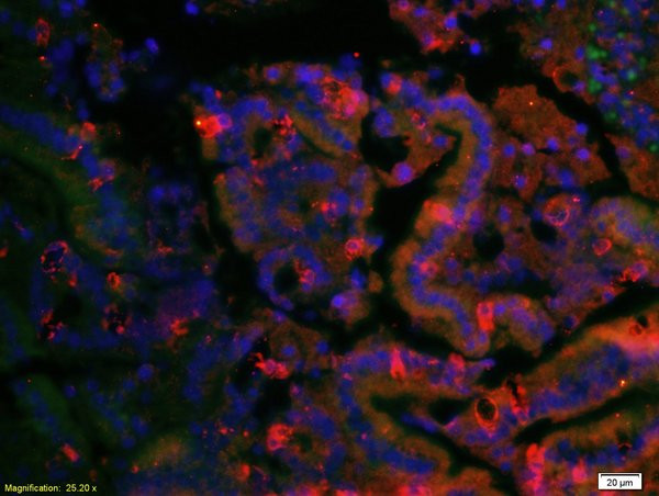 LONP1 Antibody in Immunohistochemistry (Paraffin) (IHC (P))