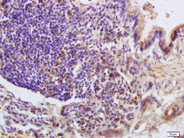 LONP1 Antibody in Immunohistochemistry (Paraffin) (IHC (P))