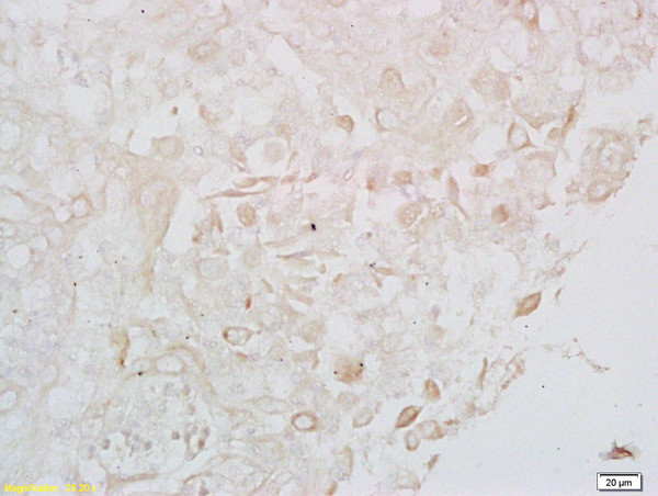 LONP1 Antibody in Immunohistochemistry (Paraffin) (IHC (P))