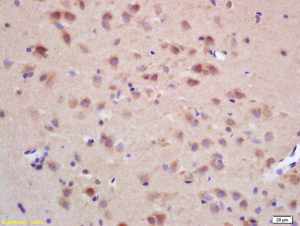 CHRNB Antibody in Immunohistochemistry (Paraffin) (IHC (P))