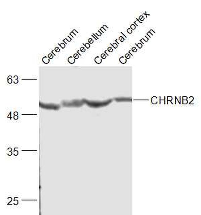 CHRNB Antibody in Western Blot (WB)