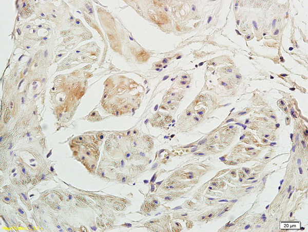 P2X3 Antibody in Immunohistochemistry (Paraffin) (IHC (P))