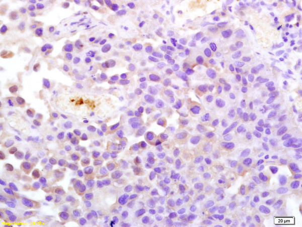 ATP1A1 Antibody in Immunohistochemistry (Paraffin) (IHC (P))