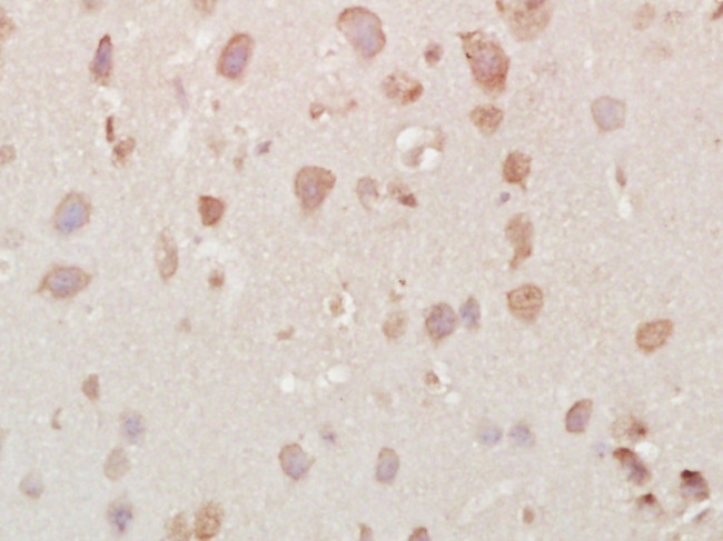 Vesicle docking protein p115 Antibody in Immunohistochemistry (Paraffin) (IHC (P))