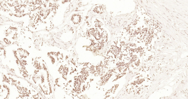 XPB Antibody in Immunohistochemistry (Paraffin) (IHC (P))