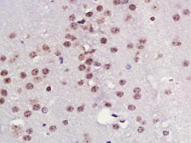 TPX2 Antibody in Immunohistochemistry (Paraffin) (IHC (P))