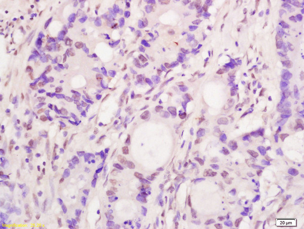 Bub1 Antibody in Immunohistochemistry (Paraffin) (IHC (P))