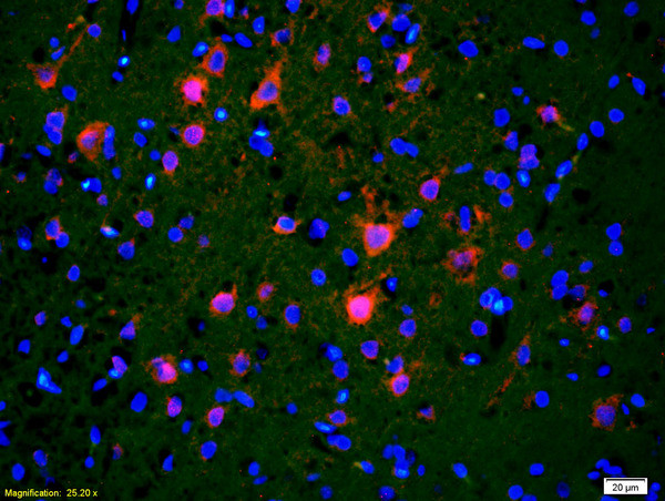 CDC40 Antibody in Immunohistochemistry (Paraffin) (IHC (P))