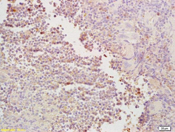 CDC40 Antibody in Immunohistochemistry (Paraffin) (IHC (P))