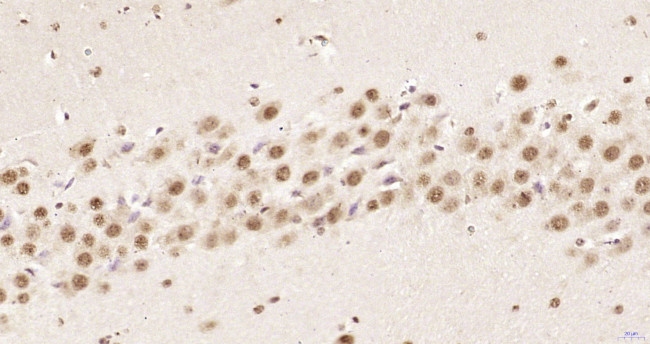 hnRNP K Antibody in Immunohistochemistry (Paraffin) (IHC (P))