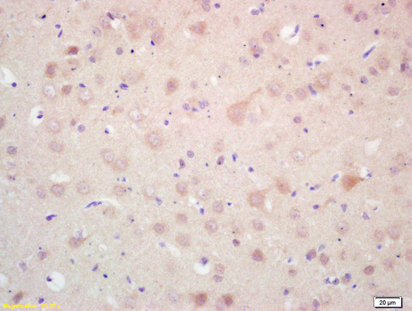 MAP 1A/1B LC3 Alpha/Beta Antibody in Immunohistochemistry (Paraffin) (IHC (P))