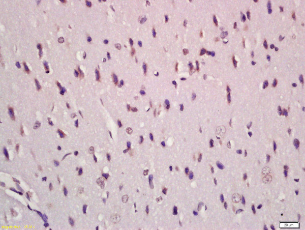 TGF Beta 1+2+3 Antibody in Immunohistochemistry (Paraffin) (IHC (P))