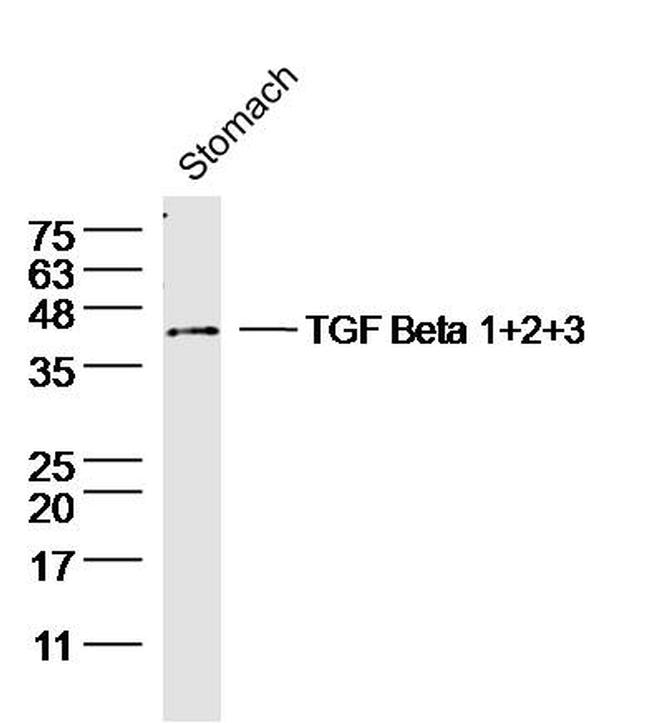 TGF Beta 1+2+3 Antibody in Western Blot (WB)