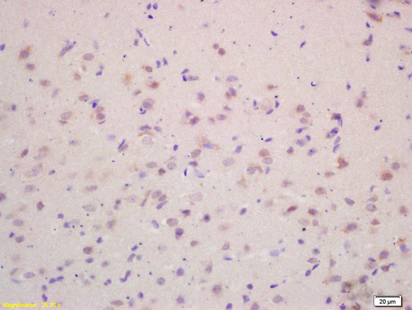 VEGF-A Antibody in Immunohistochemistry (Paraffin) (IHC (P))