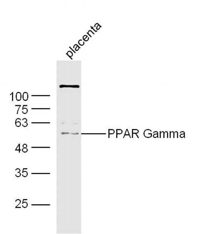 PPAR Gamma Antibody in Western Blot (WB)