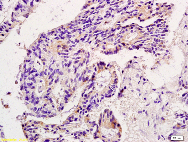 MMP9 Antibody in Immunohistochemistry (Paraffin) (IHC (P))