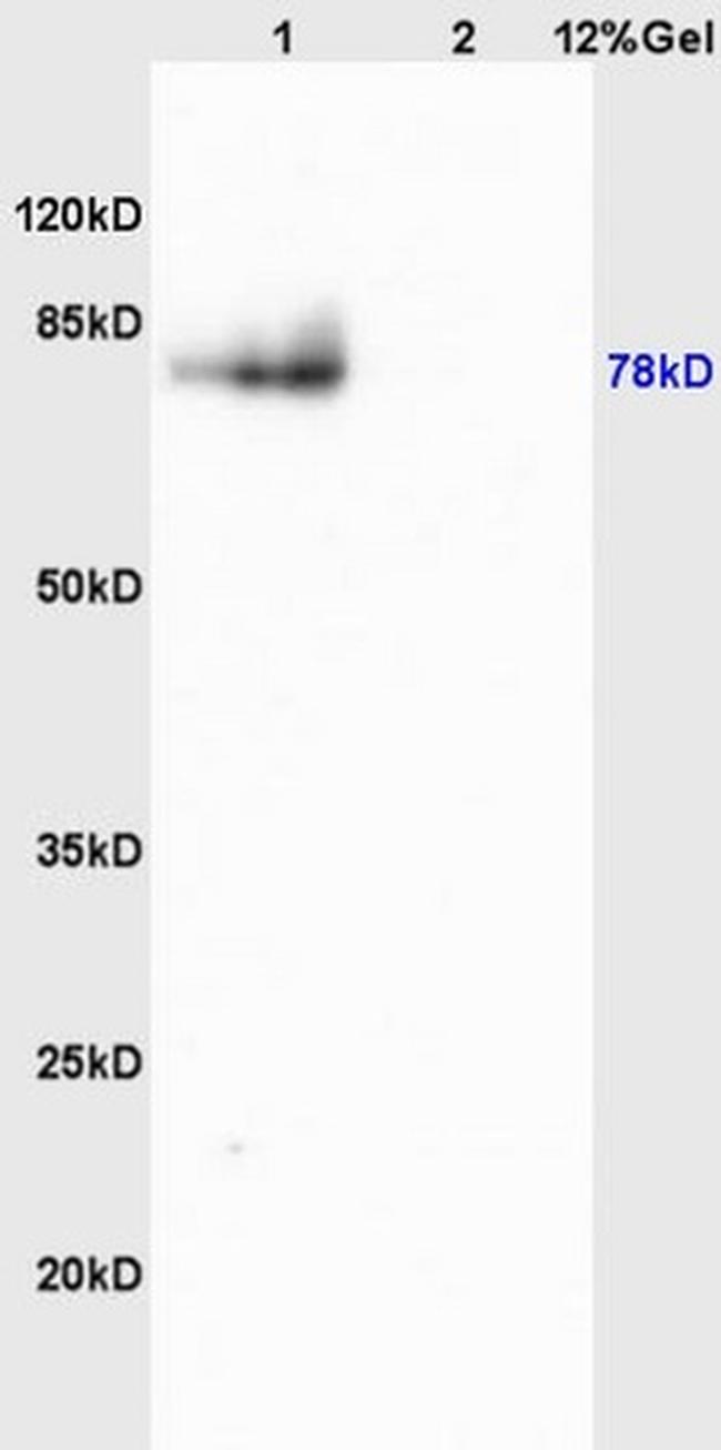 MMP9 Antibody in Western Blot (WB)