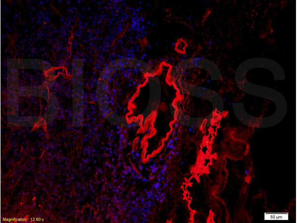 Collagen 4 Antibody in Immunohistochemistry (Paraffin) (IHC (P))