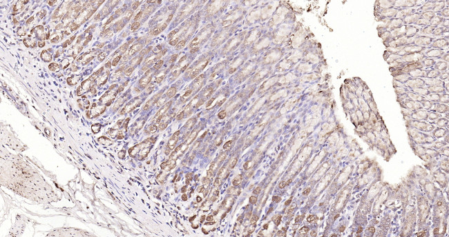 MMP-1 Antibody in Immunohistochemistry (Paraffin) (IHC (P))