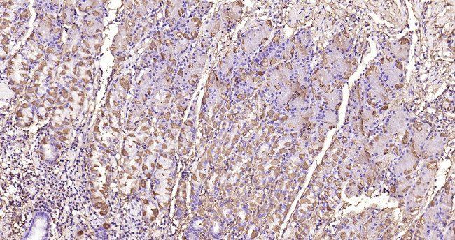 MMP-1 Antibody in Immunohistochemistry (Paraffin) (IHC (P))