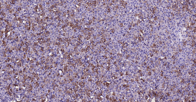 MMP-1 Antibody in Immunohistochemistry (Paraffin) (IHC (P))