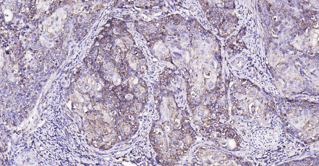 MMP-1 Antibody in Immunohistochemistry (Paraffin) (IHC (P))