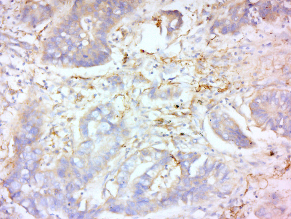 MMP-2 Antibody in Immunohistochemistry (Paraffin) (IHC (P))