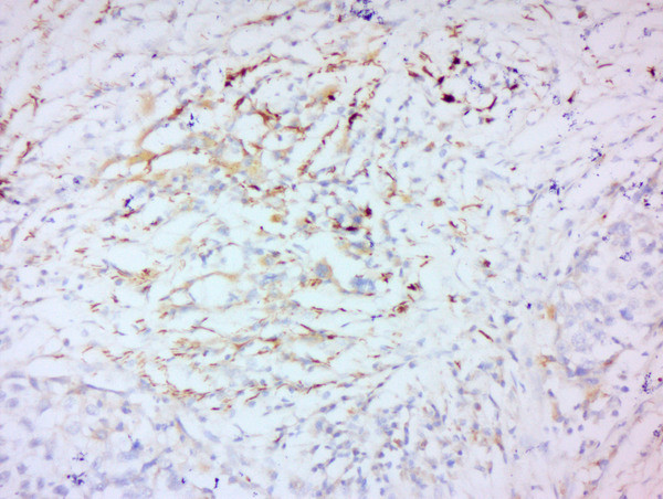 MMP-2 Antibody in Immunohistochemistry (Paraffin) (IHC (P))