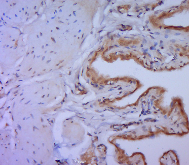 MMP-2 Antibody in Immunohistochemistry (Paraffin) (IHC (P))