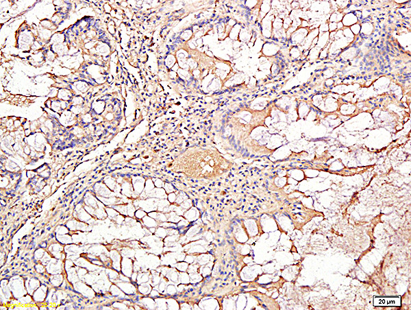 TIMP-1 Antibody in Immunohistochemistry (Paraffin) (IHC (P))