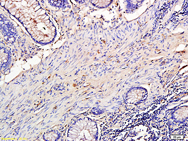 TIMP-1 Antibody in Immunohistochemistry (Paraffin) (IHC (P))