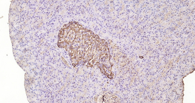 TIMP-1 Antibody in Immunohistochemistry (Paraffin) (IHC (P))