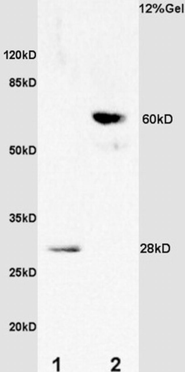 TIMP-1 Antibody in Western Blot (WB)
