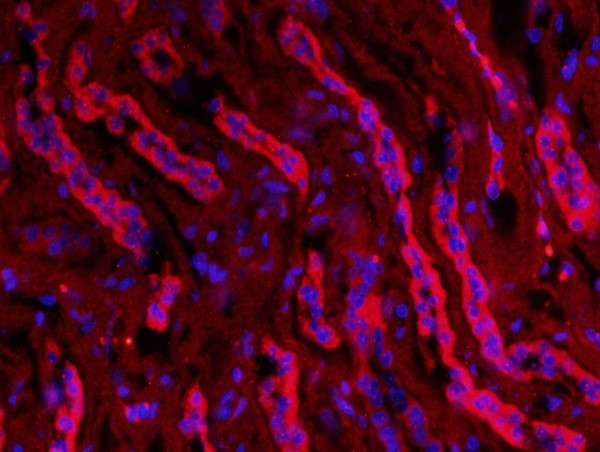 AQP2 Antibody in Immunohistochemistry (Paraffin) (IHC (P))