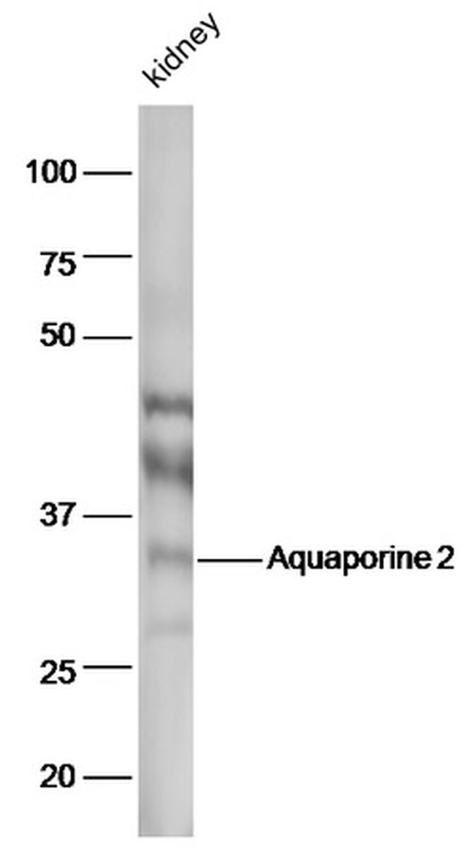 AQP2 Antibody in Western Blot (WB)