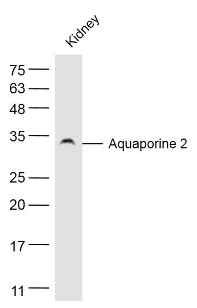 AQP2 Antibody in Western Blot (WB)