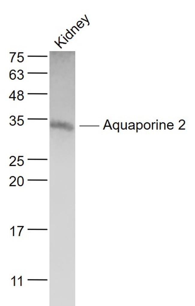 AQP2 Antibody in Western Blot (WB)