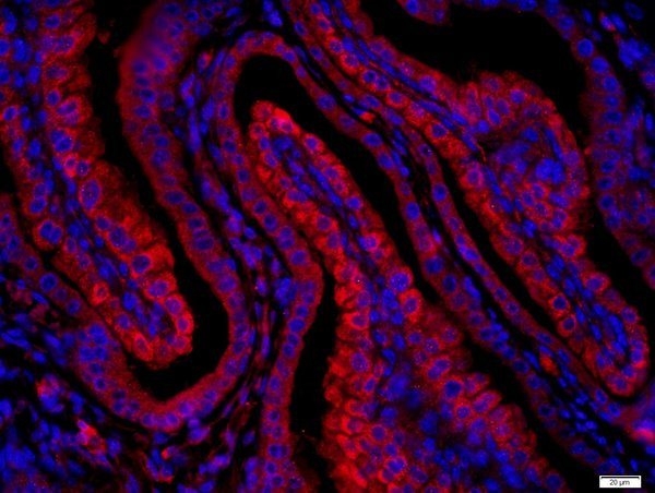 Layilin Antibody in Immunohistochemistry (Paraffin) (IHC (P))