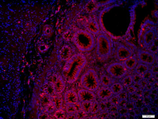 Layilin Antibody in Immunohistochemistry (Paraffin) (IHC (P))