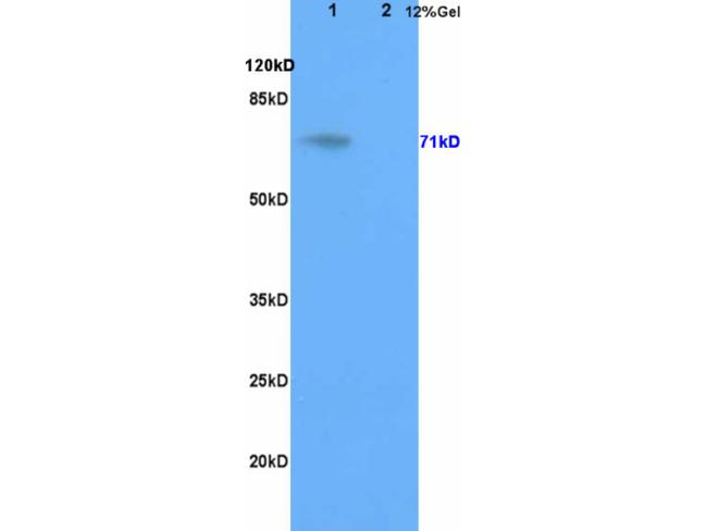 Galactocerebtosidase Antibody in Western Blot (WB)