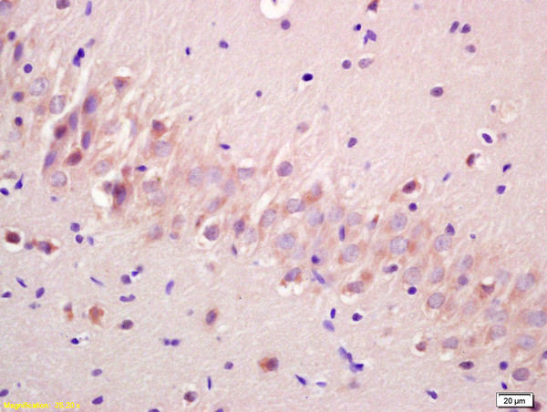 Phospho-GSK3 Alpha (Ser21) Antibody in Immunohistochemistry (Paraffin) (IHC (P))