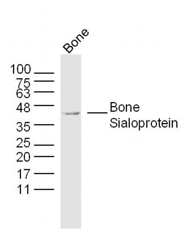 Bone Sialoprotein 1/2 Antibody in Western Blot (WB)