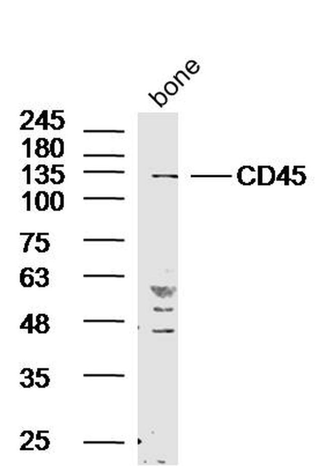 CD45 Antibody in Western Blot (WB)