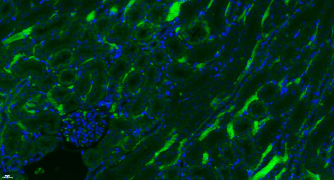 Complement C3d fragment Antibody in Immunohistochemistry (Paraffin) (IHC (P))