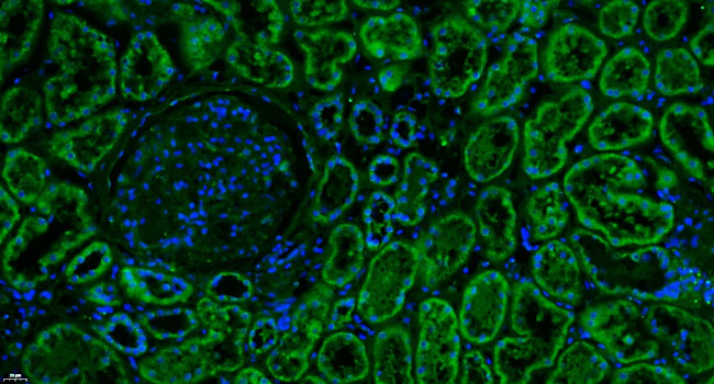 Complement C3d fragment Antibody in Immunohistochemistry (Paraffin) (IHC (P))