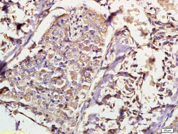 IKK alpha/beta Antibody in Immunohistochemistry (Paraffin) (IHC (P))